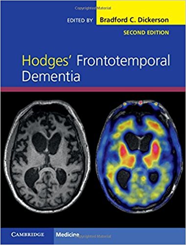 Hodges' Frontotemporal Dementia