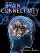 Brain Connectivity