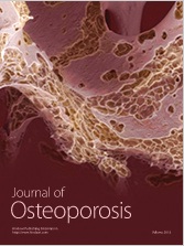 Journal of Osteoporosis