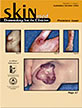 SKINmed: Dermatology for the Clinician