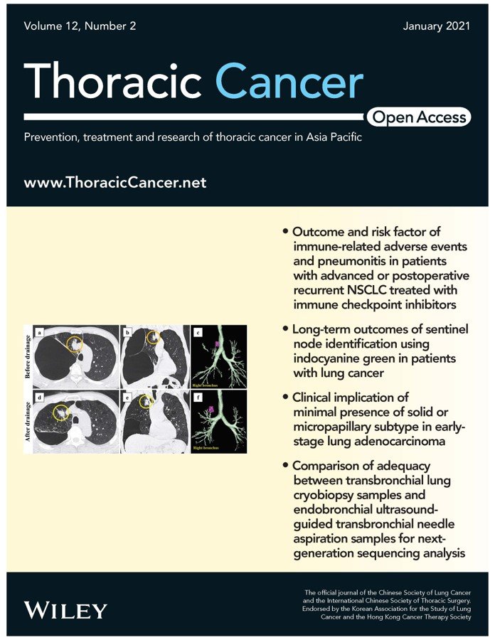 Thoracic cancer